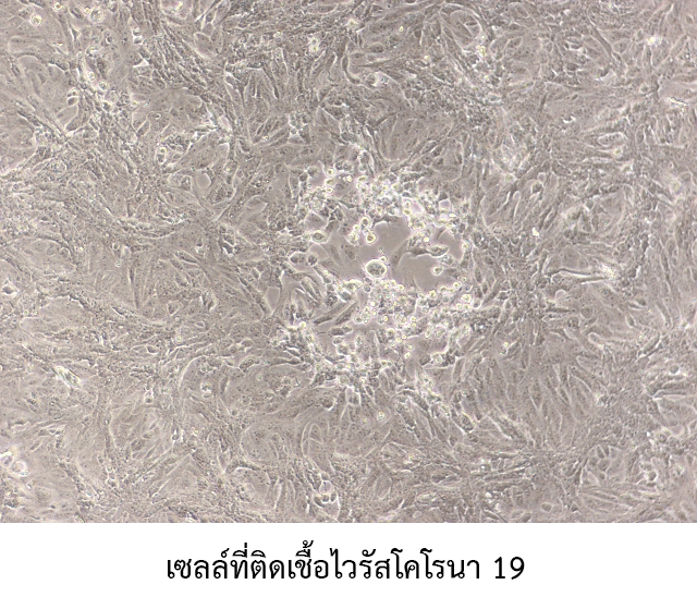 10 3 เซลล์ที่ติดเชื้อไวรัสโคโรนา 19