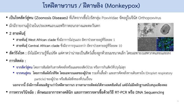 ฝีดาษลิง ลักษณะโรค1