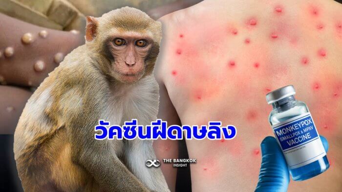 วัคซีนฝีดาษลิง