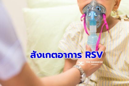 รูปข่าว เชื้อไวรัส RSV กำลังระบาด ติดต่อง่ายในเด็ก ผู้ปกครองเช็คอาการบุตรหลานด่วน