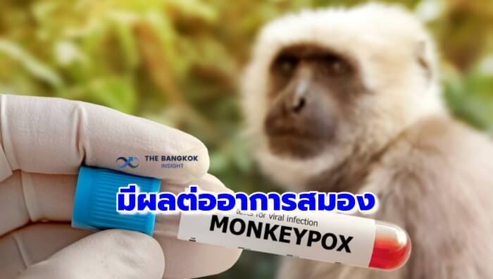 ไวรัสฝีดาษลิง
