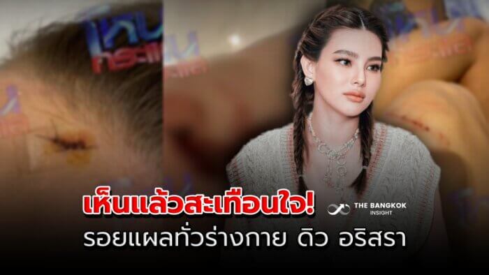 ปกแผลดิว