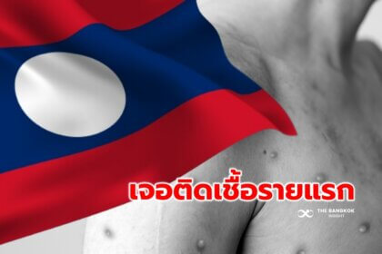 รูปข่าว ‘ลาว’ เจอ ผู้ป่วย ‘โรคฝีดาษลิง’ รายแรก สั่งเฝ้าระวังทั่วประเทศ